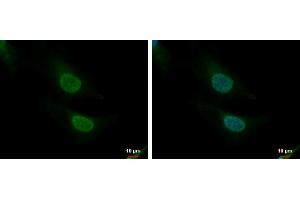 ICC/IF Image CNOT8 antibody detects CNOT8 protein at nucleus and cytoplasm by immunofluorescent analysis. (CNOT8 Antikörper)