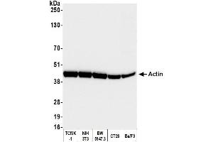 Western Blotting (WB) image for anti-Cytoskeletal Actin (CIMG_00972) (N-Term) antibody (ABIN7453904) (Cytoskeletal Actin (CIMG_00972) (N-Term) Antikörper)