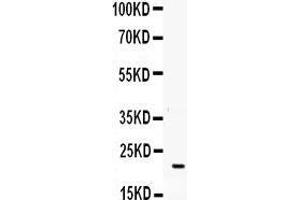Observed bind size: 22KD (G-CSF Antikörper  (AA 38-207))