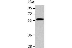 Western Blot analysis of K562 cell using ALDH1A2 Polyclonal Antibody at dilution of 1:400