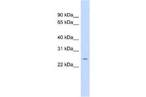 CRP antibody used at 1 ug/ml to detect target protein. (CRP Antikörper  (N-Term))
