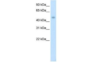WB Suggested Anti-PTDSR Antibody Titration:  1. (JMJD6 Antikörper  (C-Term))