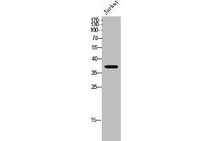 Western Blot analysis of Jurkat cells using Peropsin Polyclonal Antibody (Peropsin Antikörper  (Internal Region))