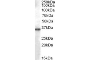 Image no. 1 for anti-Aldo-Keto Reductase Family 1, Member B10 (Aldose Reductase) (AKR1B10) (C-Term) antibody (ABIN374920) (AKR1B10 Antikörper  (C-Term))