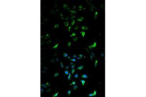 Immunofluorescence analysis of U2OS cells using STAR antibody. (STAR Antikörper)