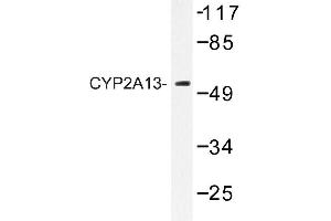 Image no. 1 for anti-Cytochrome P450, Family 2, Subfamily A, Polypeptide 13 (CYP2A13) antibody (ABIN272274)