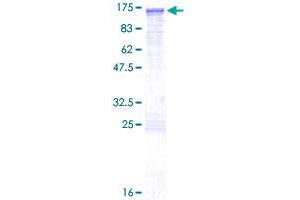 Image no. 1 for Active BCR-Related (ABR) (AA 1-859) protein (GST tag) (ABIN1305549) (ABR Protein (AA 1-859) (GST tag))