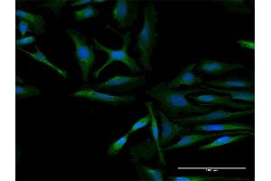 Immunofluorescence of purified MaxPab antibody to RARS2 on HeLa cell. (RARS2 Antikörper  (AA 1-578))