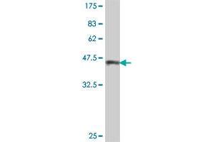 Western Blot detection against Immunogen (39. (Tuberin Antikörper  (AA 540-658))