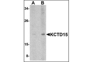 Western blot analysis of KCTD15 in human spleen tissue lysate with this product at (A) 0. (KCTD15 Antikörper  (C-Term))