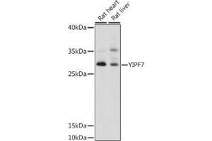 Western blot analysis of extracts of various cell lines, using YIPF7 antibody (ABIN7271420) at 1:1000 dilution. (YIPF7 Antikörper  (AA 1-80))