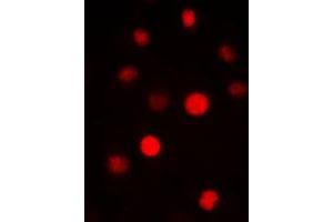 Immunofluorescent analysis of SAP14 staining in HepG2 cells. (Pre-mRNA Branch Site Protein p14 (SF3B14) (C-Term) Antikörper)