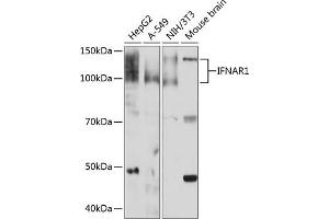 Western blot analysis of extracts of various cell lines, using IFN Rabbit mAb (ABIN1682980, ABIN3015227, ABIN3015228 and ABIN7101324) at 1:1000 dilution. (IFNAR1 Antikörper)