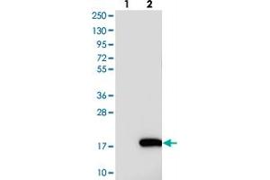 Western blot analysis of Lane 1: Negative control (vector only transfected HEK293T lysate), Lane 2: Over-expression Lysate (Co-expressed with a C-terminal myc-DDK tag (~3. (NRARP Antikörper)