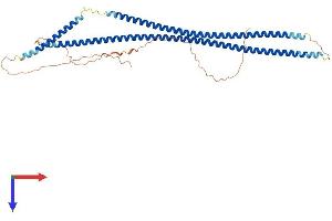 Keratin 40 (KRT40) (AA 1-439) protein (His tag)