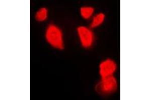 Immunofluorescent analysis of CHK1 staining in HeLa cells. (CHEK1 Antikörper  (Center))
