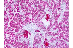 Anti-LYPLAL1 antibody IHC of human pancreas. (LYPLAL1 Antikörper  (C-Term))