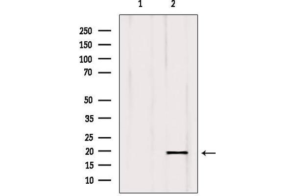 ISCU antibody  (Internal Region)
