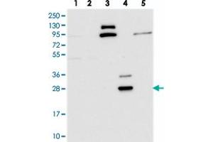 Western blot analysis of Lane 1: RT-4, Lane 2: U-251 MG, Lane 3: Human Plasma, Lane 4: Liver, Lane 5: Tonsil with CYB561D2 polyclonal antibody . (CYB561D2 Antikörper)