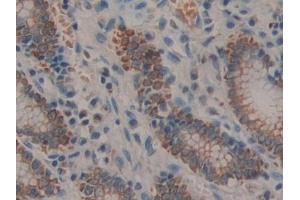 Immunohistochemistry (IHC) image for anti-Prolactin Receptor (PRLR) (AA 25-234) antibody (ABIN7443311)