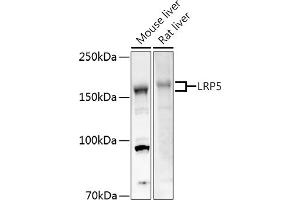 Western blot analysis of extracts of various cell lines, using LRP5 antibody (ABIN1513164, ABIN3020644, ABIN3020646 and ABIN6213630) at 1:500 dilution. (LRP5 Antikörper  (AA 1000-1250))