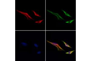 ABIN7093921 and ABIN7097965 staining Hela cells by IF/ICC. (MTCH2 Antikörper  (C-Term))