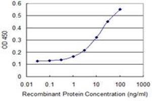 Detection limit for recombinant GST tagged AIP is 0. (AIP Antikörper  (AA 156-249))