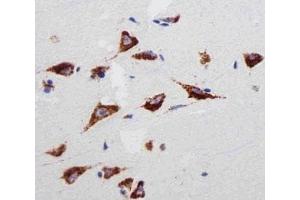 Immunohistochemistry (IHC) image for anti-Ribosomal Protein S6 (RPS6) antibody (ABIN3028983)