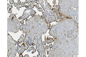 IHC analysis of RAB1B using anti-RAB1B antibody (ABIN7602809). (RAB1B Antikörper  (C-Term))