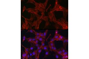 Immunofluorescence (IF) image for anti-Gelsolin (GSN) (AA 543-782) antibody (ABIN7267365)