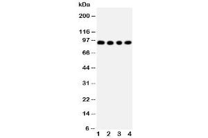 Western blot testing of ADAM17 antibody and Lane 1:  human placenta (ADAM17 Antikörper  (C-Term))
