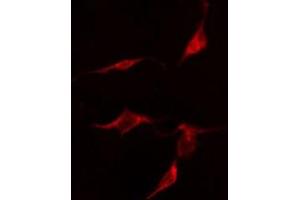 ABIN6275848 staining  HepG2 cells by IF/ICC. (MASTL Antikörper  (C-Term))