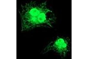 Anti-GDAP1L1 mouse monoclonal antibody (ABIN2454765) immunofluorescent staining of COS7 cells transiently transfected by pCMV6-ENTRY GDAP1L1 (RC200976). (GDAP1L1 Antikörper)