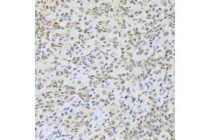 Immunohistochemistry of paraffin-embedded mouse lung using HMGB1 Antibody. (HMGB1 Antikörper  (AA 100-200))