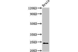 Western Blotting (WB) image for anti-NADH Dehydrogenase (Ubiquinone) Fe-S Protein 8, 23kDa (NADH-Coenzyme Q Reductase) (NDUFS8) (AA 35-210) antibody (ABIN7160970)