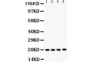 Western Blotting (WB) image for anti-Parkinson Protein 7 (PARK7) (AA 2-189) antibody (ABIN3043589) (PARK7/DJ1 Antikörper  (AA 2-189))