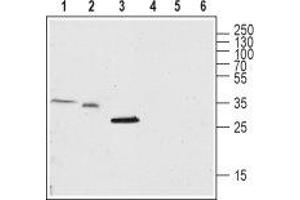 Western blot analysis of rat brain lysate (lanes 1 and 4), and mouse brain membrane (lanes 2 and 5) and skeletal muscle (lanes 3 and 6): - 1-3. (TMEM38A Antikörper  (C-Term, Intracellular))