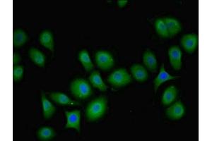 Immunofluorescent analysis of A549 cells using ABIN7163201 at dilution of 1:100 and Alexa Fluor 488-congugated AffiniPure Goat Anti-Rabbit IgG(H+L) (PIP4K2B Antikörper  (AA 1-270))
