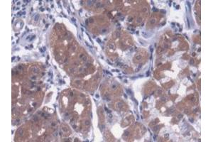 DAB staining on IHC-P; Samples: Human Stomach Tissue (Metaxin 1 Antikörper  (AA 175-387))
