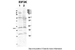 Sample Type: 1. (EIF3K Antikörper  (C-Term))