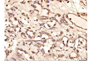 IHC analysis of AASS using anti-AASS antibody (ABIN7601519). (AASS Antikörper  (AA 37-865))