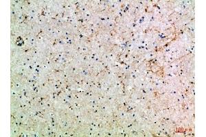 Immunohistochemical analysis of paraffin-embedded Human-brain, antibody was diluted at 1:100.