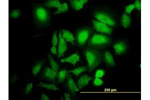 Image no. 1 for anti-ABL2 (ABL2) (AA 743-842) antibody (ABIN465946) (ABL2 Antikörper  (AA 743-842))
