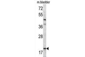 Western Blotting (WB) image for anti-BCL2-Associated Agonist of Cell Death (BAD) (BH3 Domain) antibody (ABIN2997223) (BAD Antikörper  (BH3 Domain))