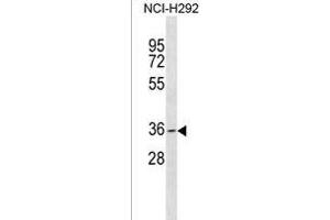 anti-Growth Differentiation Factor 5 Opposite Strand (GDF5OS) (AA 206-232), (C-Term) antibody