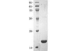 Western Blotting (WB) image for Microtubule-Associated Protein tau (MAPT) (Transcript Variant 6) protein (His tag) (ABIN2712319)