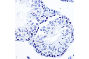Immunohistochemistry of paraffin-embedded mouse testis using Phospho-SMC1-S957 Rabbit mAb (ABIN7270613) at dilution of 1:100 (40x lens). (SMC1A Antikörper  (pSer957))