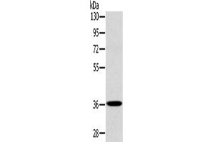 Western Blotting (WB) image for anti-PDZ and LIM Domain 1 (PDLIM1) antibody (ABIN2423956) (PDLIM1 Antikörper)