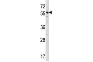 BMP3 antibody western blot analysis in ZR-75-1 lysate. (BMP3 Antikörper  (AA 318-347))