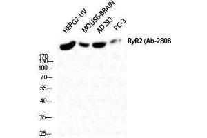 Western Blotting (WB) image for anti-Ryanodine Receptor 2 (Cardiac) (RYR2) (Tyr1018) antibody (ABIN3177320) (RYR2 Antikörper  (Tyr1018))